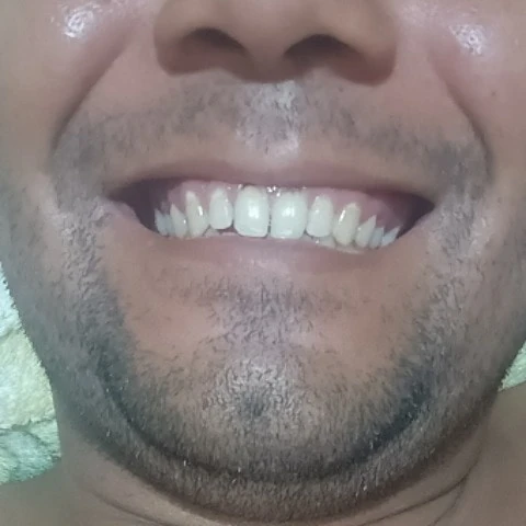 Lucpt