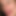 facialabusegirl