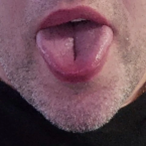 LoveLickVad