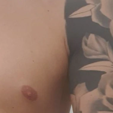 Gtof5