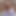 Millionhair