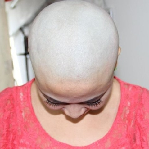 baldprincess