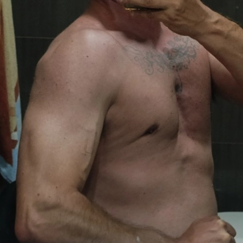 SinpeloSobreRuedas83