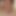 myopic123