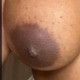 DrippingBalloons22