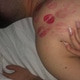 AbsorbedBall9