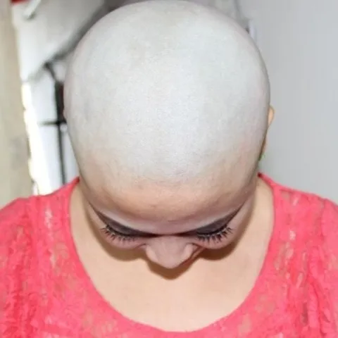 baldprincess