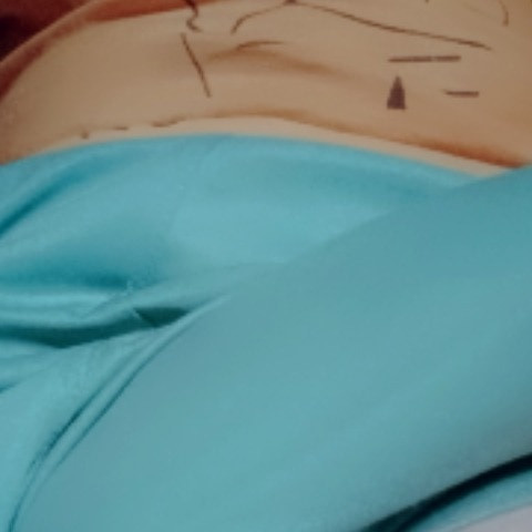SqueakyMargin62