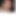 foreskin63