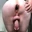 Fistloch-LE
