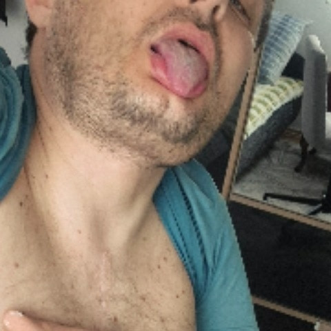 matteoderpe