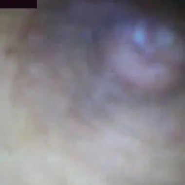 Beeangle