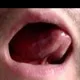 Deepthroat_Germany