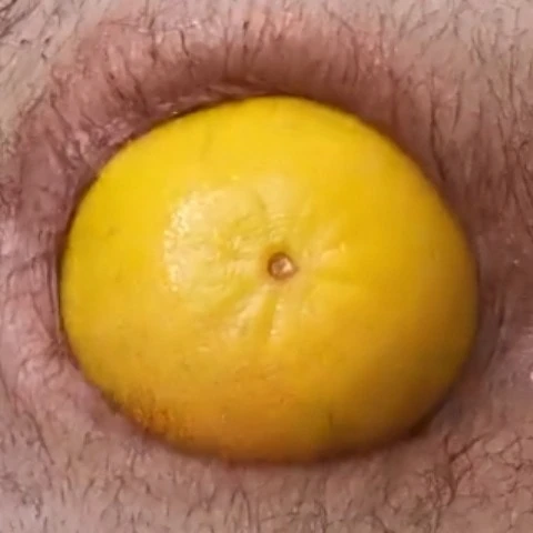 Analgames427