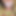 LumpyMonitor19