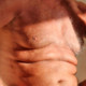 vitalicio7
