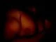 -BrTz-