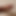UnnaturalForearm7
