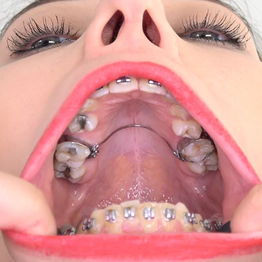 InsideMyMouth