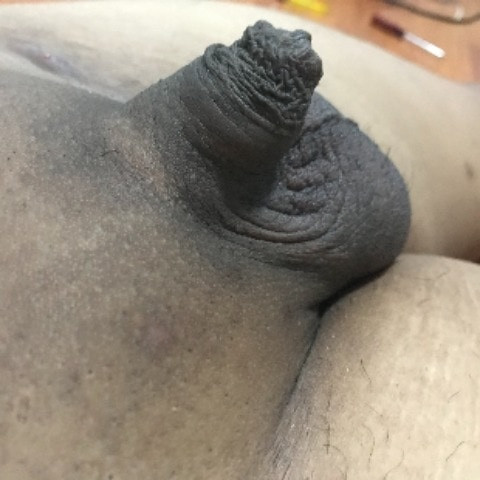 Artthai001
