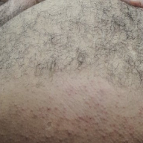 ALAA123456-