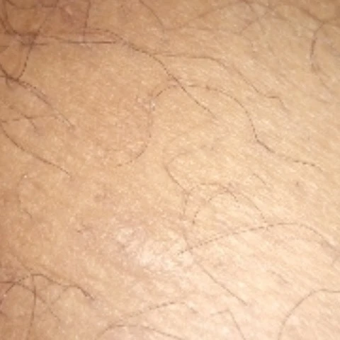 NoticedDragon7