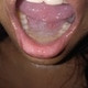 EcstaticApparatus209