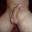 Artax_1