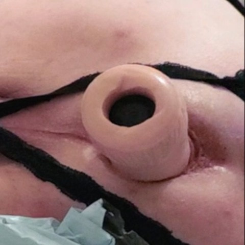 gaped1