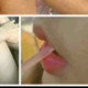 Sabinasona