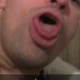 Raupleasr