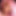 allysinp