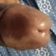 Adhee007