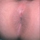 Envidebite