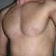 appolons