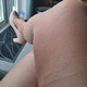 antechtights