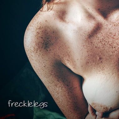 frecklelegs