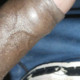 Ananadosa