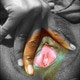 Desisucking