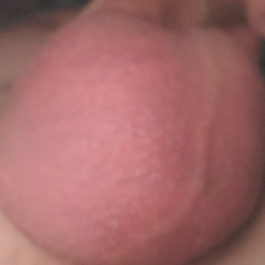 Billanal555