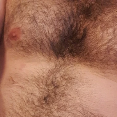 Feri396