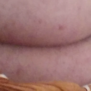 moh_oss