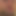 Bigdick_niederrhein