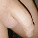 moabiti64