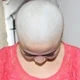 baldprincess