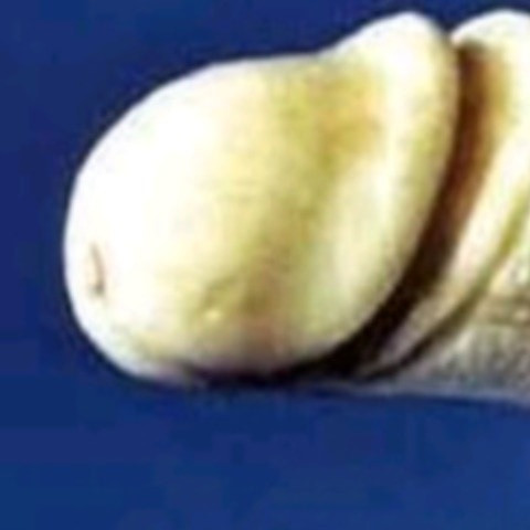 Erectbanana