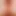 TearlessAnal