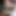 Leg-