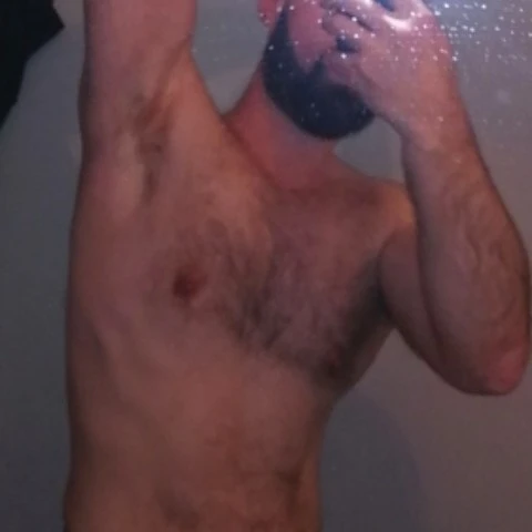 vitiligo_small_cock