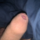 ForeskinChamp